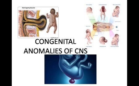 Prevalence and Patterns of Major Congenital Anomalies in Riyadh Tertiary Care Centers