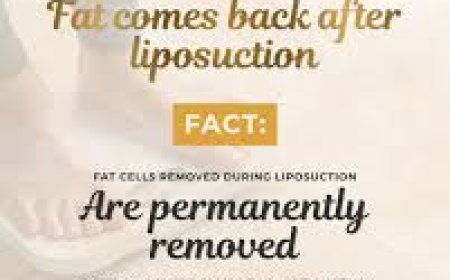 How fat cells are permanently removed in liposuction