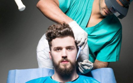 Recovery Lifestyle Adjustments After a Beard Transplant Procedure