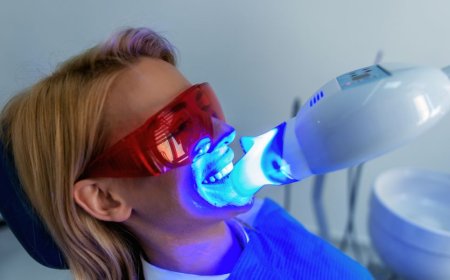 Same-Day Teeth Whitening in Brisbane City: Is It Worth It?