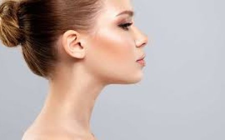 Chin shaping and profile balancing using fillers