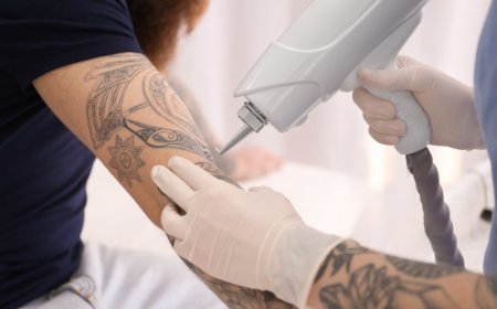 Emotional reasons people choose tattoo removal
