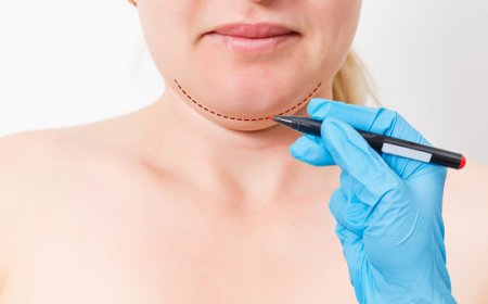 Customized Facial Aesthetics: Chin Reduction Specialists in Riyadh
