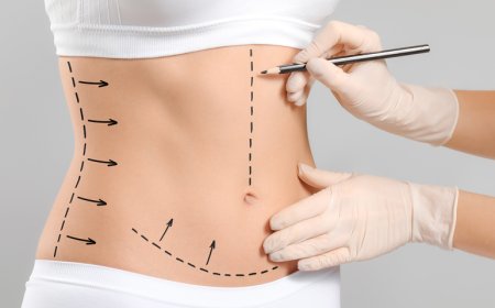 Combination of liposuction with other cosmetic procedures