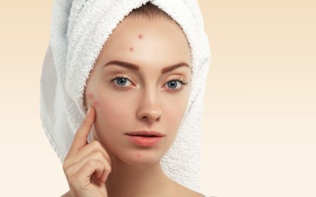 Acne Treatment In Manchester – Advanced Solutions for Clearer, Healthier Skin