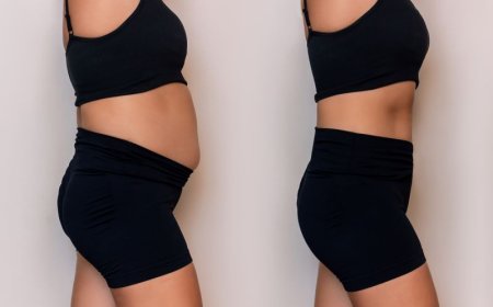 Is Vaser 4D Liposuction the key to refined fat sculpting?