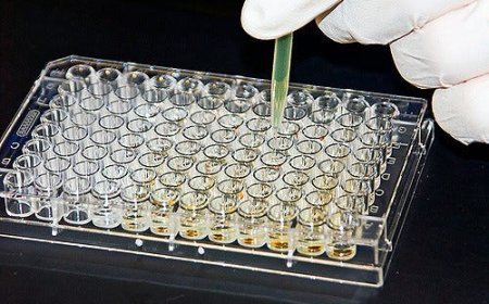 Advanced ELISA Method Innovations Transforming Medical Diagnostics