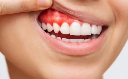 Why Are My Gums Bleeding When I Brush? | Bryn Mawr