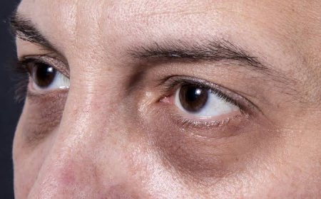 Eye Bag Removal can it restore fresh under eye glow?