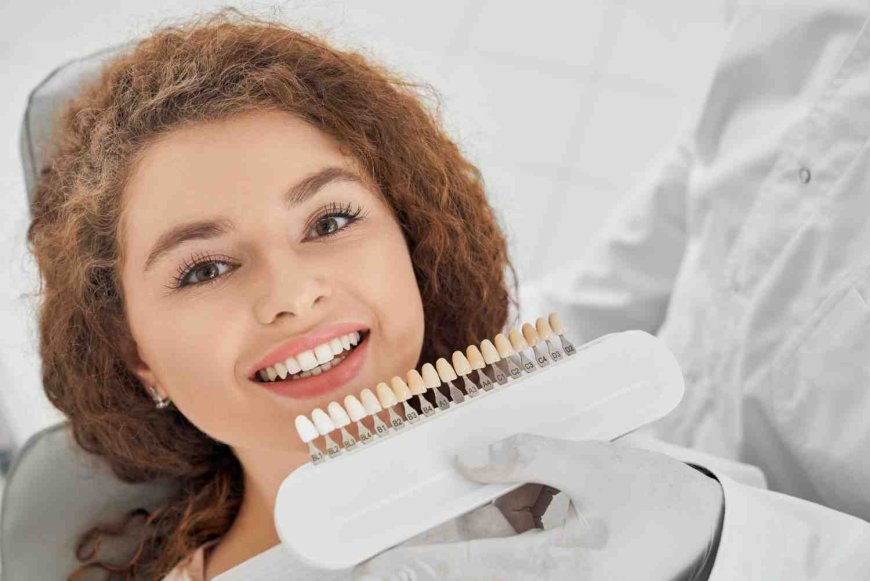 How Are the Best Dental Veneers Applied to Natural Teeth?