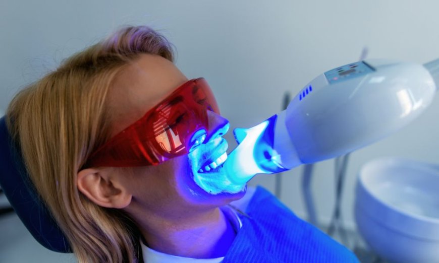 Same-Day Teeth Whitening in Brisbane City: Is It Worth It?