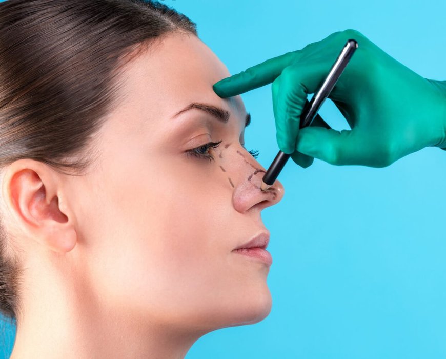 Exercise restrictions after rhinoplasty