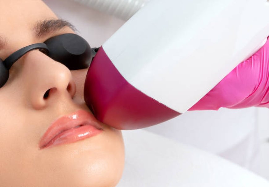 Is IPL Photofacial Near Boston Worth It For Clearer Skin?