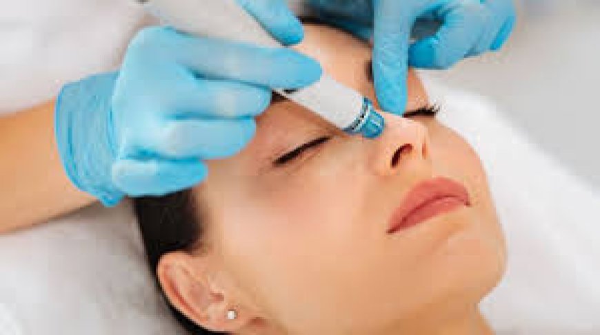Hydrafacial and its exfoliation process explained