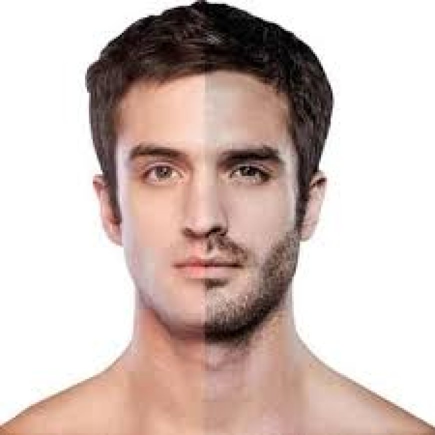 Beard Hair Transplant for Scar Coverage in Riyadh