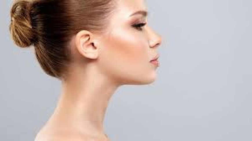 Chin shaping and profile balancing using fillers