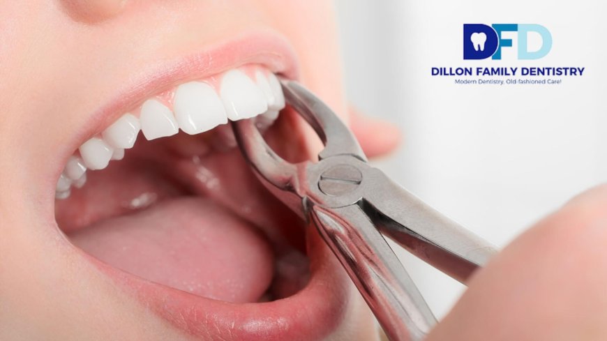 How Painful Is a Tooth Extraction? Bryn Mawr Dentist Guide