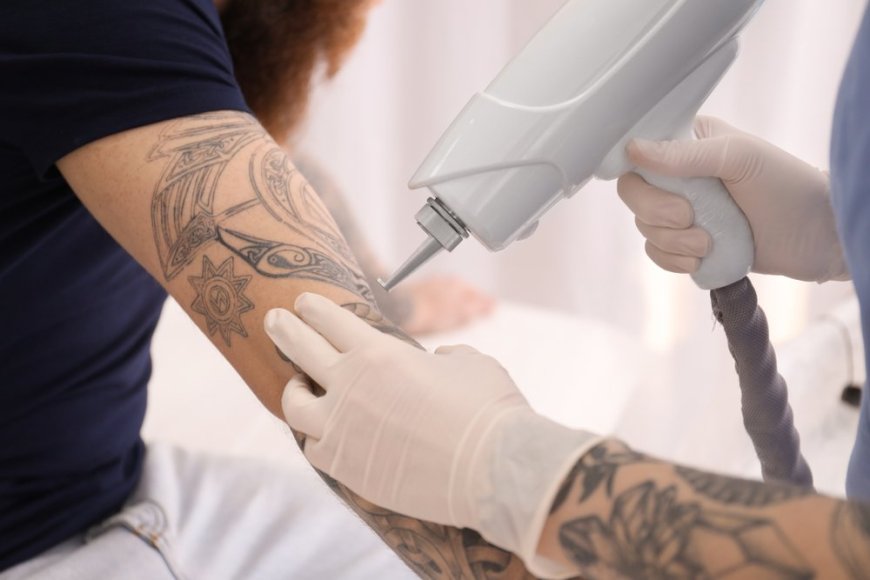 Emotional reasons people choose tattoo removal