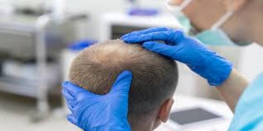 Long-Term Value of Hair Transplant Procedures in Riyadh