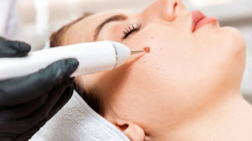 Why Riyadh Residents Choose Professional Clinics for Skin Care
