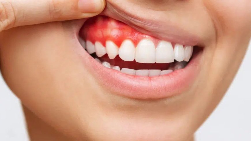 Why Are My Gums Bleeding When I Brush? | Bryn Mawr