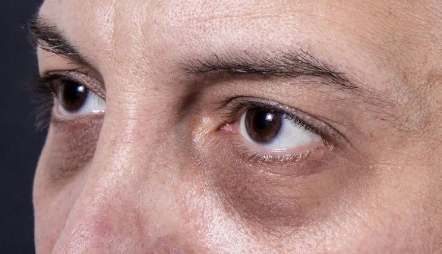 Eye Bag Removal can it restore fresh under eye glow?