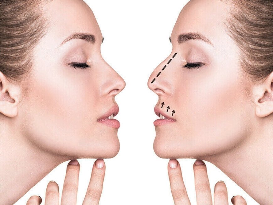 Discover Trusted Experts for Rhinoplasty in Dubai