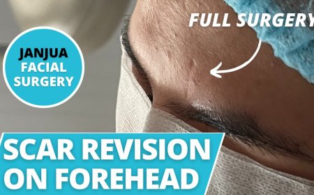 From Trauma to Transformation: The Power of Scar Revision