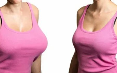 Breast Augmentation in Gurgaon – Enhance Your Confidence with Expert Cosmetic Care