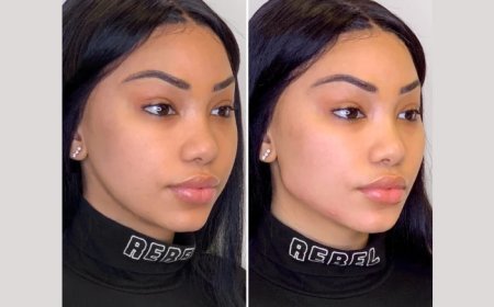 Best Plastic Surgeons in Dubai for Advanced Facial Lifting