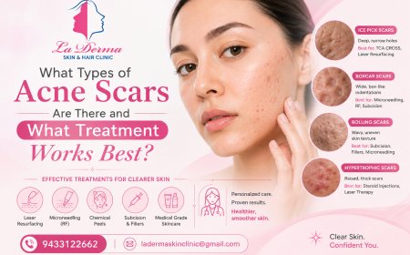 What Types of Acne Scars Are There and What Treatment Works Best?