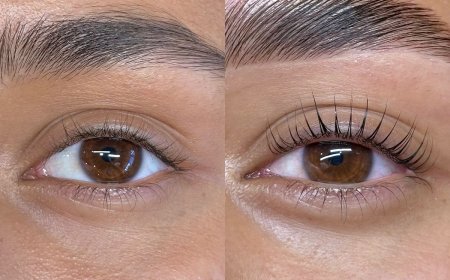 Eyelash Hair Transplant in Dubai: Proven Medical Results