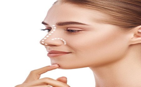Rhinoplasty in Dubai: Defining Your Best Facial Profile