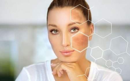 Can Skin Reuvenation improve confidence?