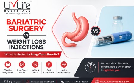 Bariatric Surgery vs Weight Loss Injections: Which Is Better for Long-Term Results?