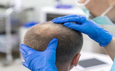 Hair transplant in Riyadh understanding graft survival rates