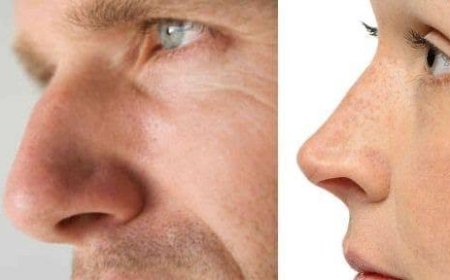 Rhinoplasty in Riyadh How Facial Features Influence Results