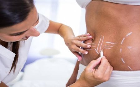 Liposuction in Riyadh and Post-Procedure Care