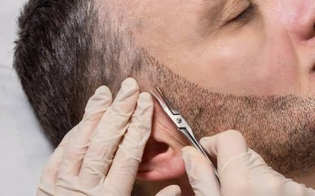 Post-Procedure Care After Beard Hair Transplant in Riyadh