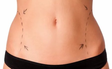 Liposuction in Dubai: Advanced Techniques and Care