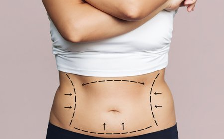 Best Tummy Tuck Surgeon in Dubai: How to Select a Trusted Specialist