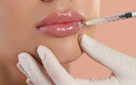 Lip Fillers injection in Dubai: Advanced Tips