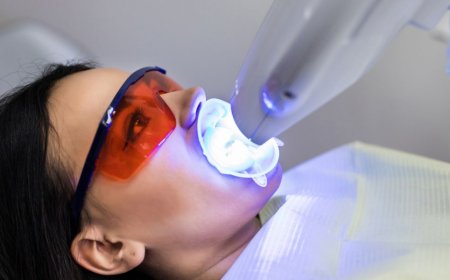 How to Keep Your White Smile After a Professional Whitening Treatment