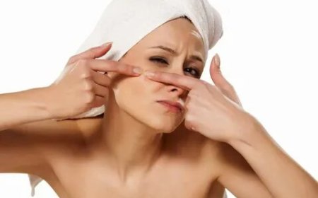 Affordable Acne Treatment Services with Personalized Skin Care Plans