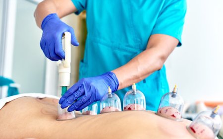 Why Hijama Therapy Is Becoming a Popular Choice for Natural Healing?
