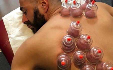 Why Hijama Therapy Is Becoming a Popular Choice for Natural Healing?