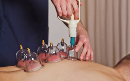 Benefits of Hijama Therapy for Better Health and Wellness