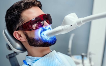 Best Teeth Whitening for Sensitive Teeth – A Complete Patient Guide