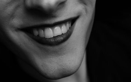 Why Is Turkey Dental Becoming a Preferred Choice for International Patients?