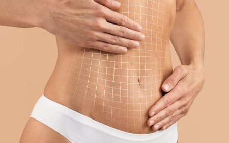 How Body Contouring in Islamabad Supports Personalized Aesthetic Goals